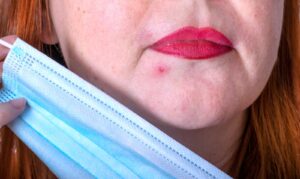 acne mascherina